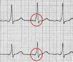 Cardiologia a latina