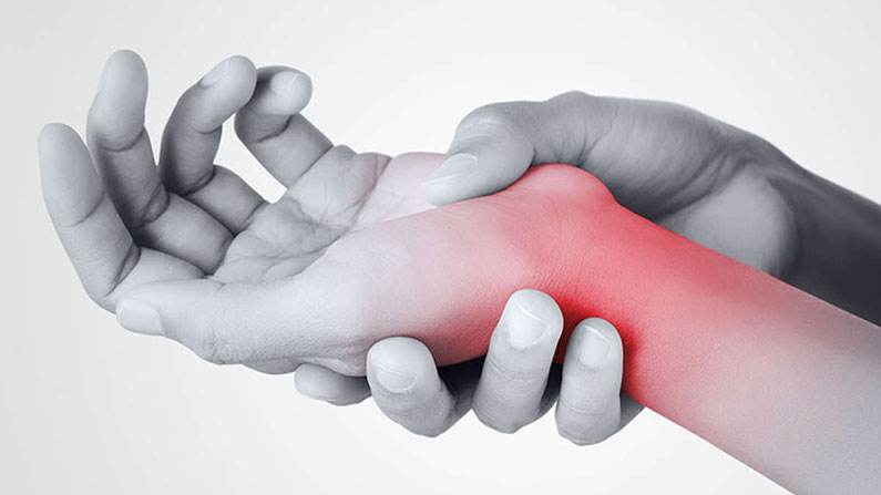 Sindrome del Tunnel Carpale: diagnosi, cause e cure
