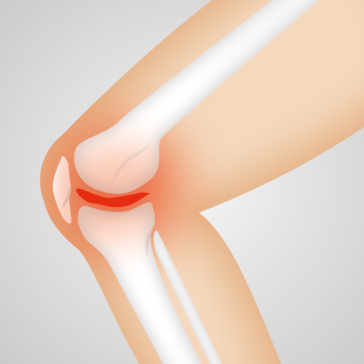 artrosi cure fisioterapia