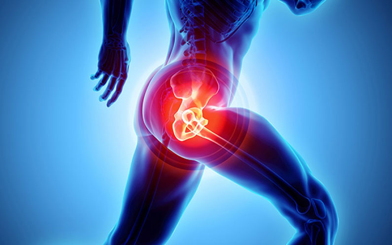 fisioterapia-protesi-anca