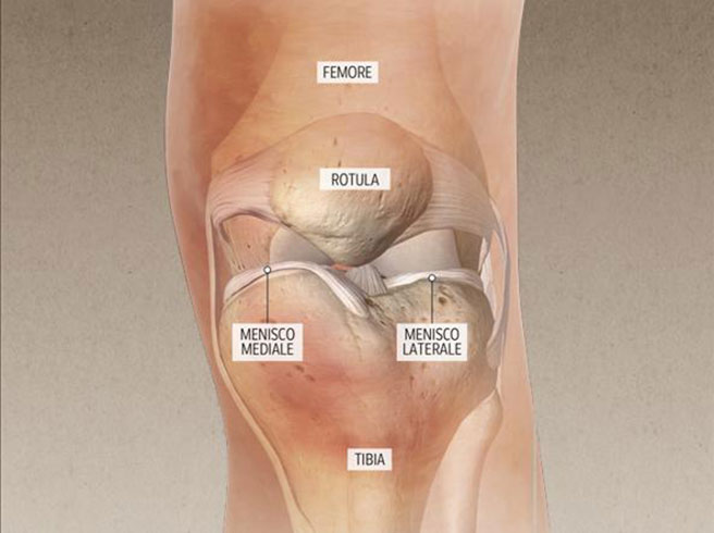 Menisco-del-ginocchio